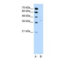 NBP1-56295